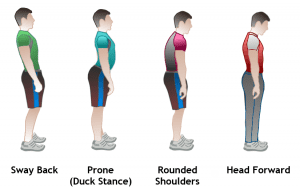 When correcting posture causes pain