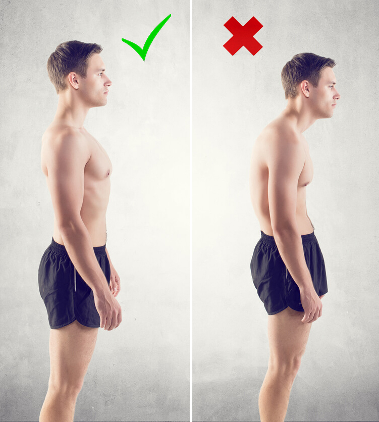 Can Bad Posture Cause Neck Pain Detailed And Complete