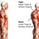 effects of bad posture on the muscular and skeletal systems