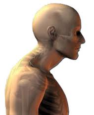 examples of bad postureexamples of bad posture