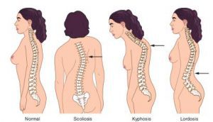 poor posture and mid back pain