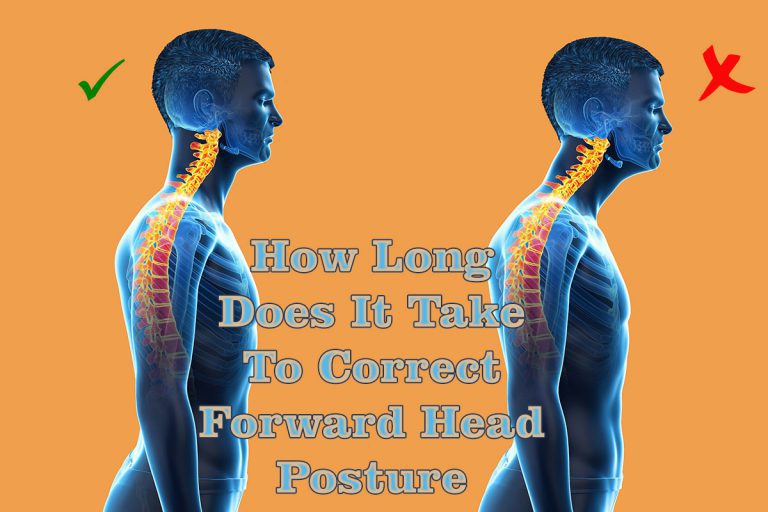 How Long Does It Take to Correct Forward Head Posture